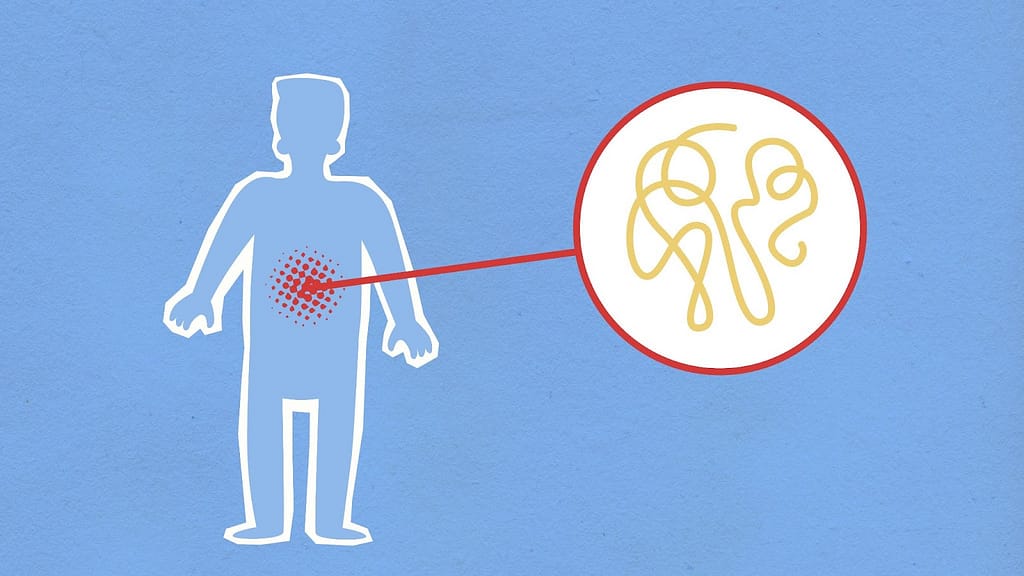 Gastrointestinal Cancer: 7 Deadly Clues